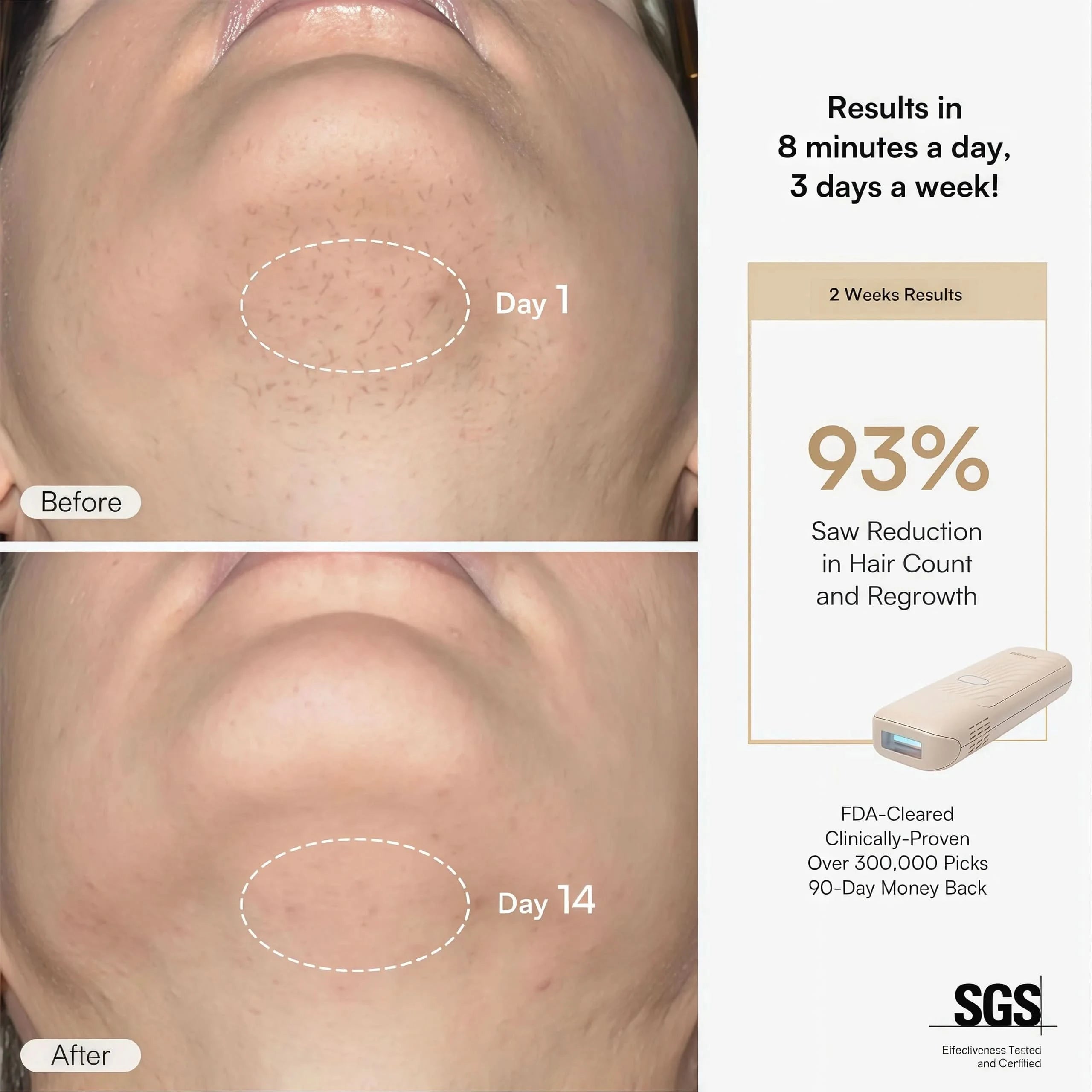 NAMI IPL Hair Removal Device
