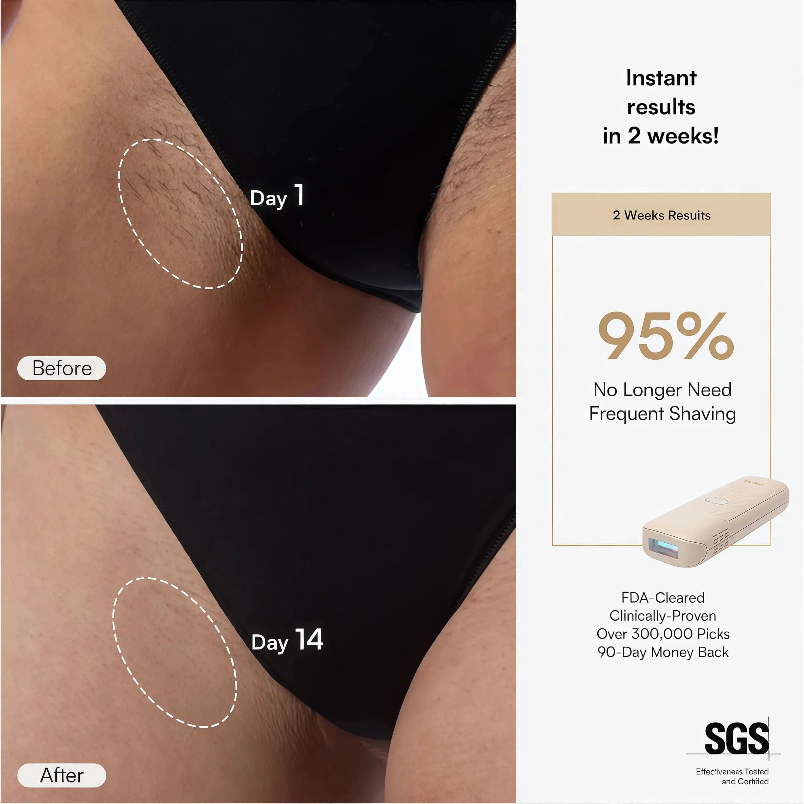 NAMI IPL Hair Removal Device
