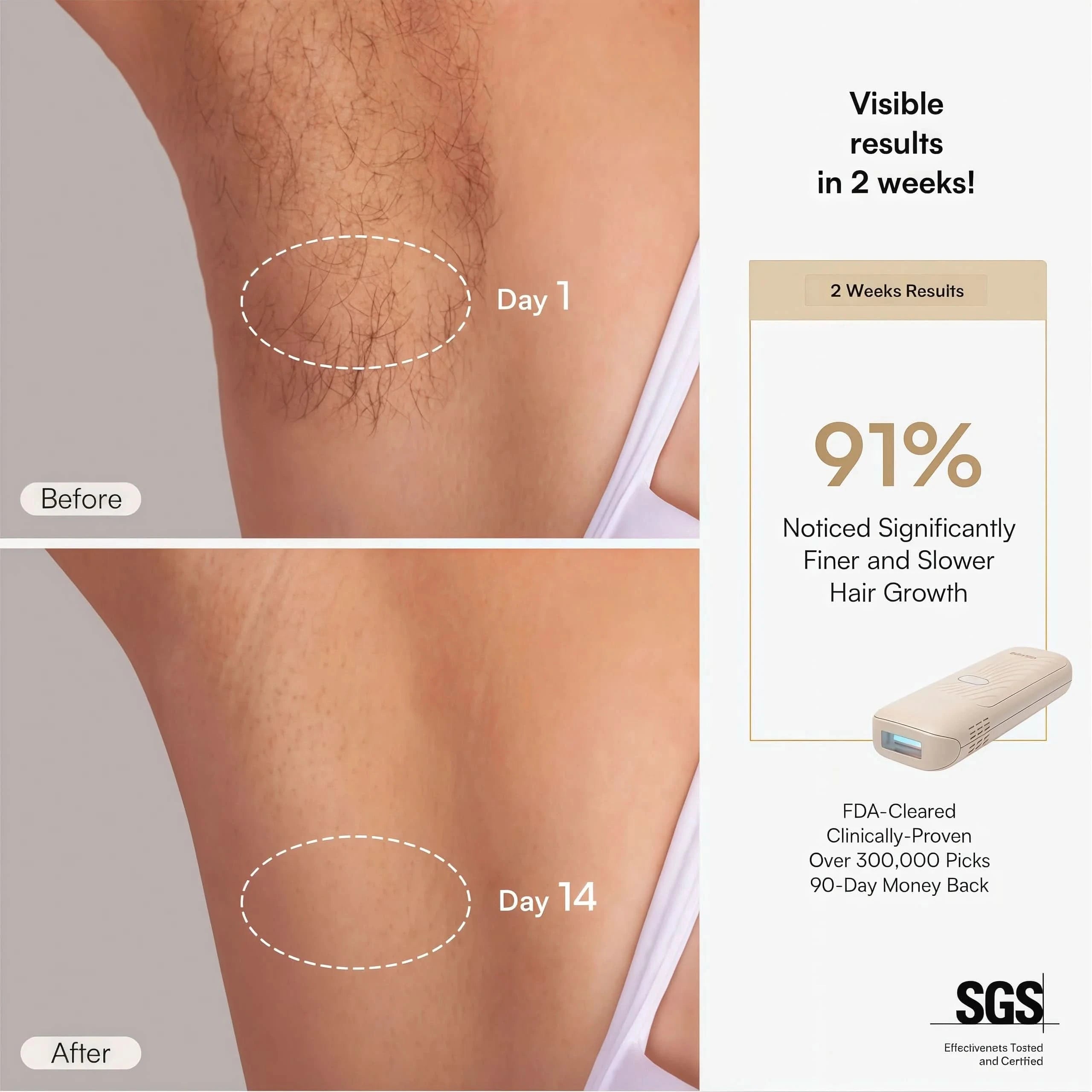 NAMI IPL Hair Removal Device